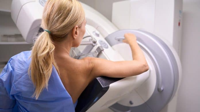Adult woman is getting digital breast tomosynthesis in clinic
